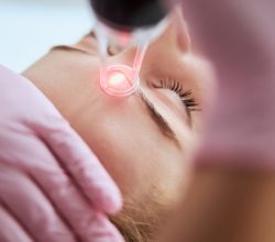 Cropped photo of a qualified lady dermatologist in latex gloves performing a facial resurfacing procedure