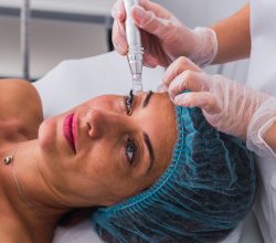 Side view of an adult woman with medical disposable cap receiving mesotherapy treatment with dermapen on face by anonymous cosmetologist in the spa center.